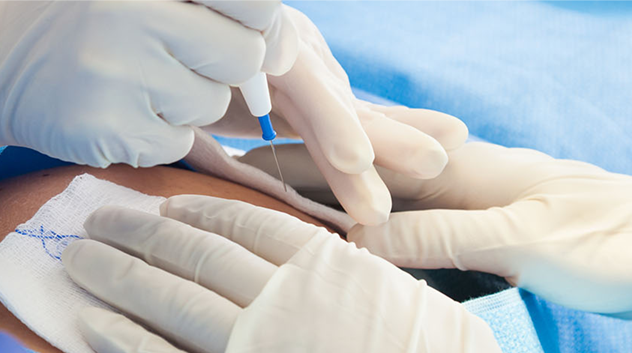 Cesarean section (C-section): Pros: