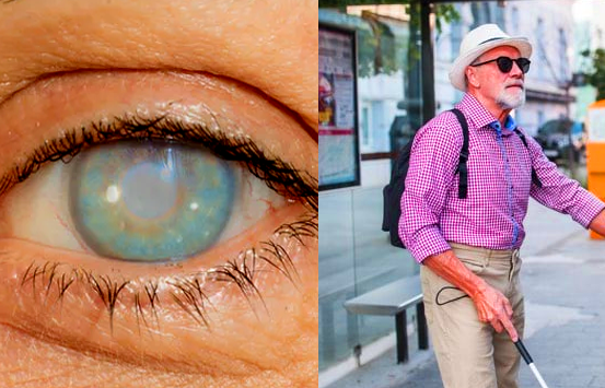Eye inflammation can lead to vision loss or blindness if left untreated