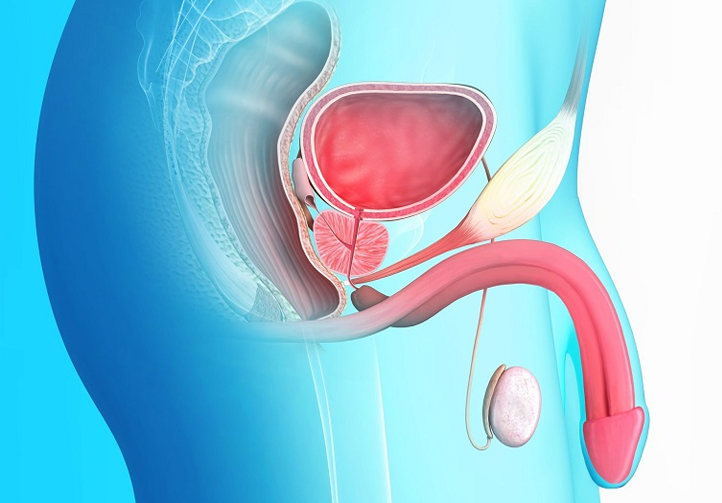 les symptômes d'un cancer de la prostate
