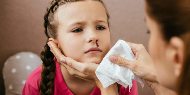 Nasal polyps are noncancerous growths that can develop in the nasal passages and can cause nosebleeds