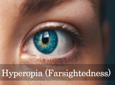 Hyperopia (Farsightedness) causes & treatmen