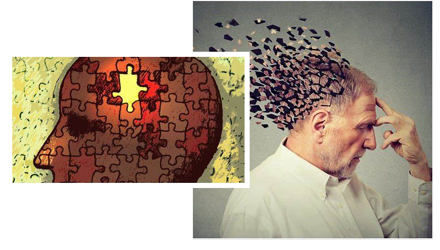 Unfortunately, there is currently no cure for Alzheimer's disease