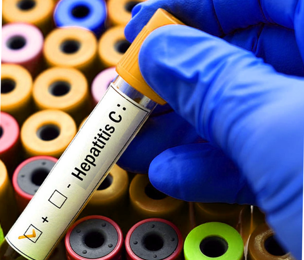 Another approach is to use genetic engineering to modify the viru