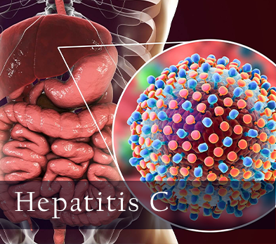 Hepatitis C Causes, infection and Treatments