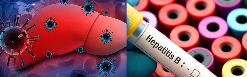 causes virus of Hepatitis B