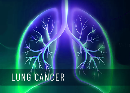 Lung Cancer: signs, cause & treatment