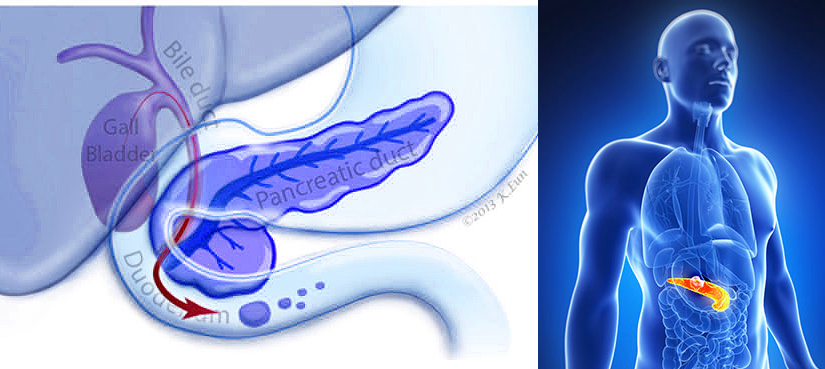 Can you survive without a pancreas?