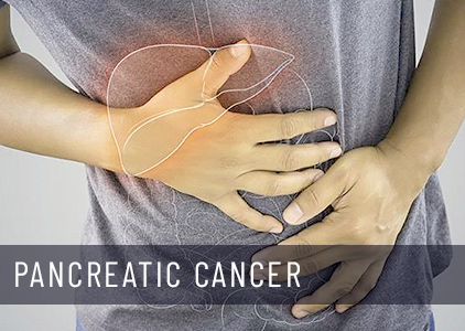 Pancreatic Cancer: signs, cause & treatment | Survival Rate