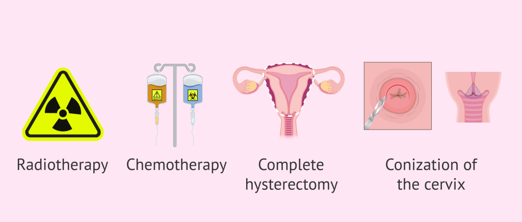 The main treatments for cervical cancer