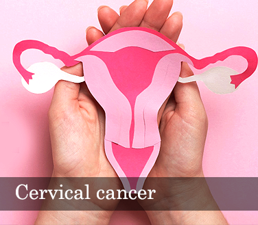 Cervical cancer: signs, cause & treatment