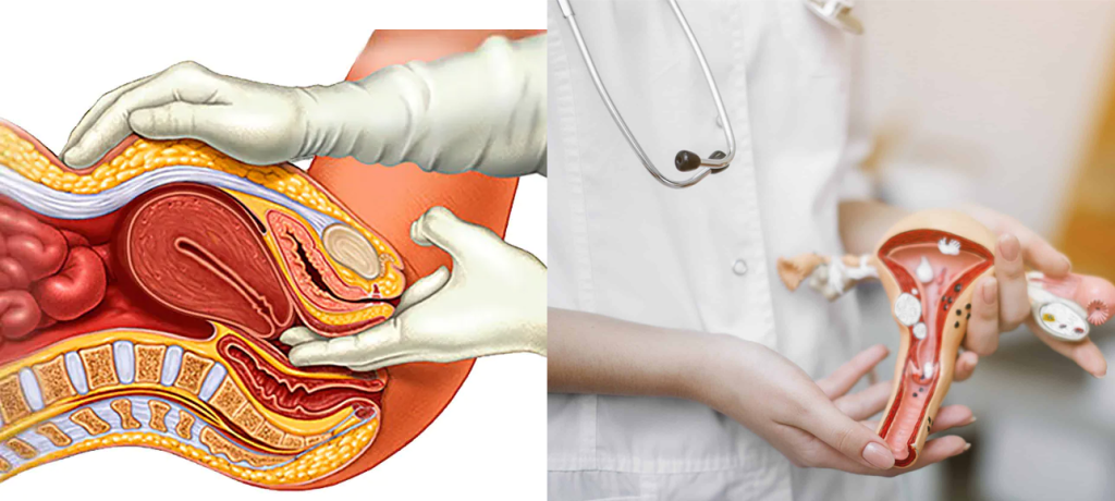 Uterine cancer is more common than cervical than cervical, ovarian, vulvar, vaginal and fallopian tube cancer