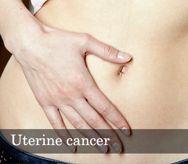 Uterine cancer : cause, signs, & treatment