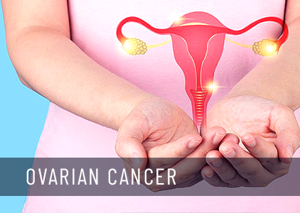Ovarian Cancer: early warning signs, Causes & Treatments