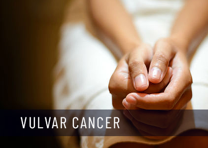 Symptoms of Vulval cancer, causes, Treatment & Prevention