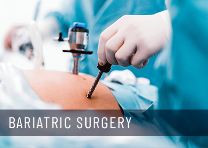 Bariatric surgery