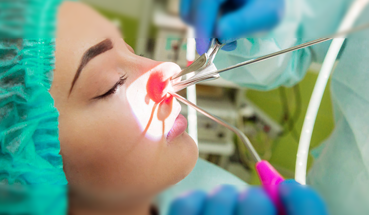 This is a procedure that involves removing excess tissue from the back of the throat, including the uvula and part of the soft palate.