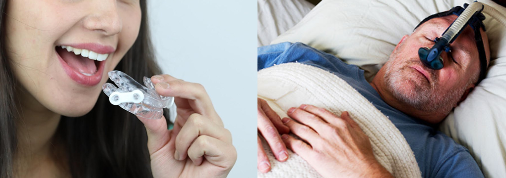 treatments for sleep apnea