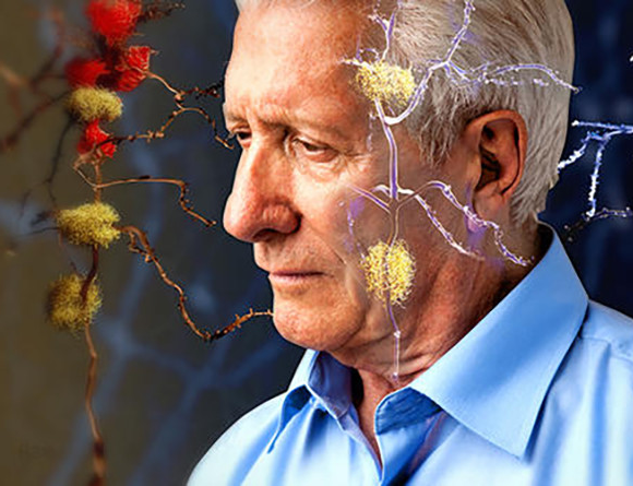 les signes de la maladie d'Alzheimer