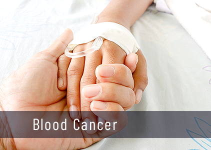 Blood Cancer Types, Symptoms & Causes | What survival rate?