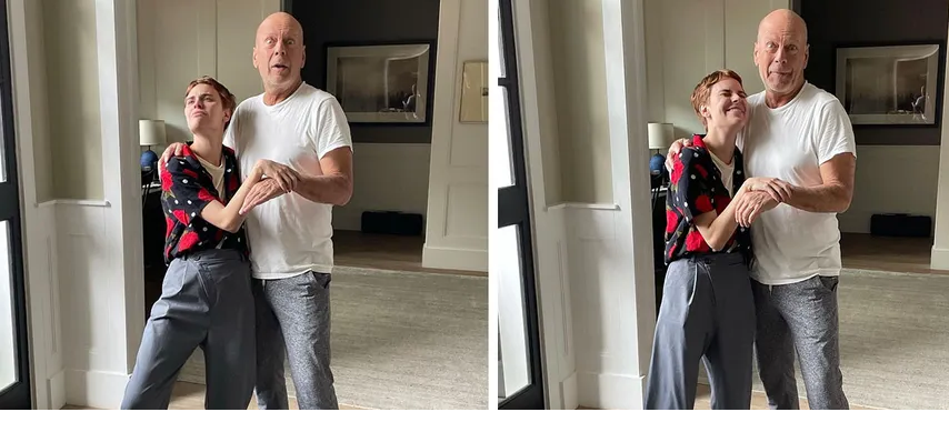 What type of aphasia does Bruce Willis suffer from?